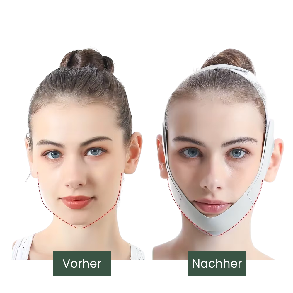 Nuvalis V-Lift Maske Anwendung – definierte Kinnkontur und Gesichtsstraffung